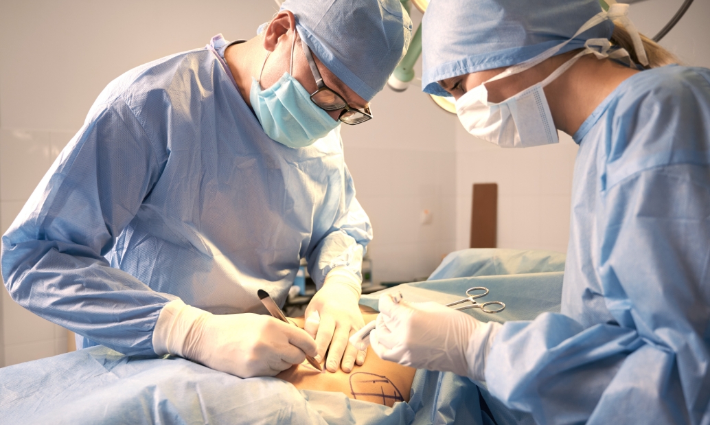 La chirurgie Endolille, Chirurgie  digestive